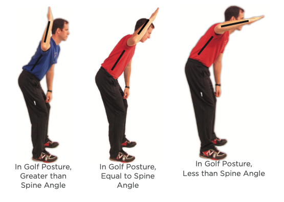 Diagram of shoulder external rotation and its effect on the golf swing path