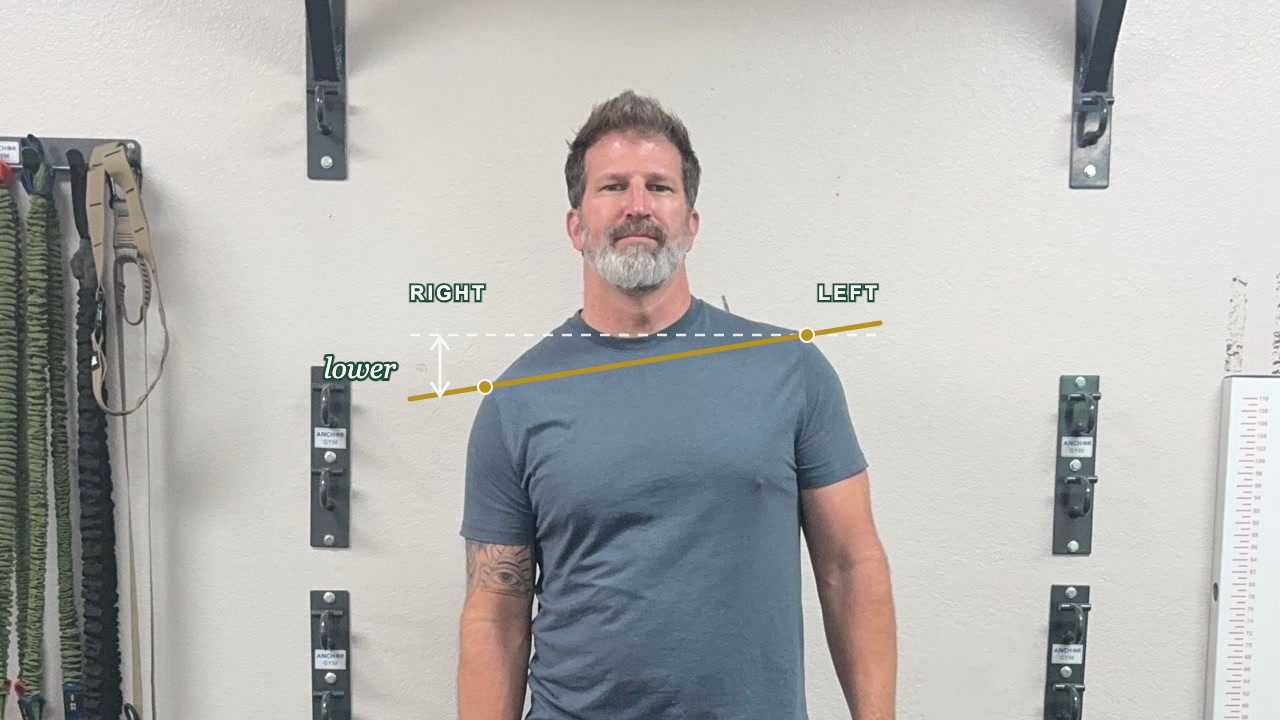 Dr. Taylor standing relaxed, facing the camera, with his right shoulder sitting lower than his left